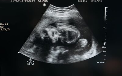 “On. Sportiello, moltissime donne soffrono dopo l’aborto!”