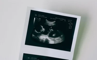 Donna incinta cerebralmente morta: il suo bimbo però è vivo!