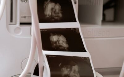 La campana per la vita, scudo per la vita nascente