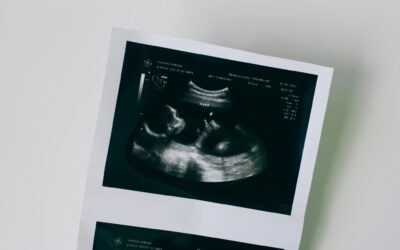 MyvoiceMychoice e la libertà di abortire:” Non vi arrendete proprio mai!”