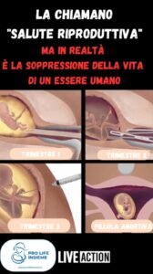 Embrione feto aborto
