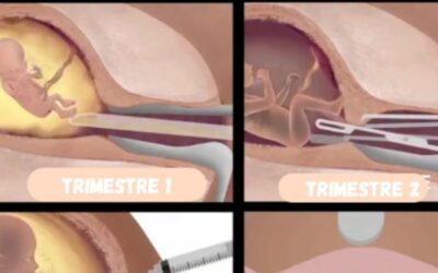 “ Grumo di cellule”? No, essere umano vivo e capace di provare dolore