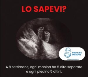Ecografia 8 settimane