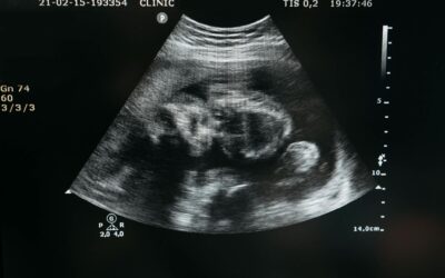 Aborto non è libertà, è la fine di una libertà più debole